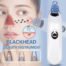 Derma Suction Blackhead Remover